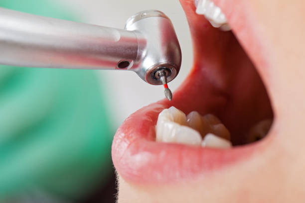Best Emergency Dental Filling Replacement  in Jackson, KY